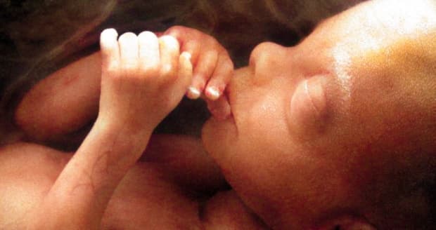 "Permitamos viver a mulher e o bebê": confira a nota da CNBB sobre o PL 1904/2024